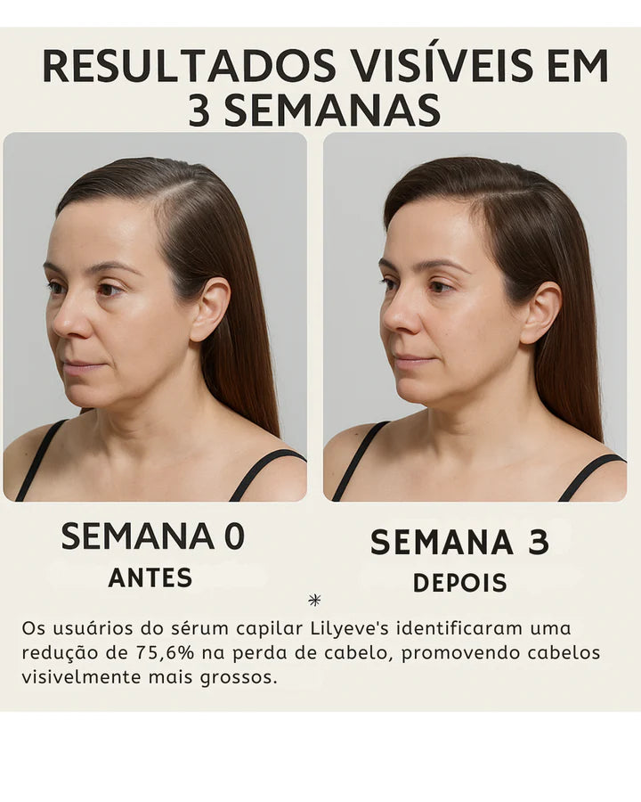 Lilyeve Hair Growth - Sérum Capilar Coreano com Exossomos 100ml