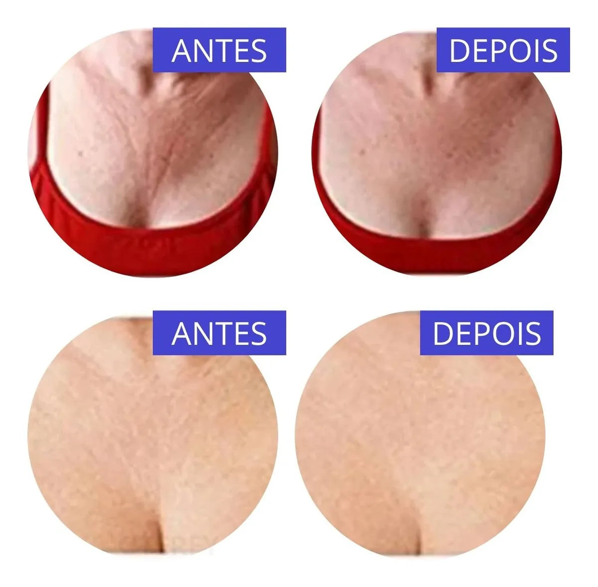 Dermalift® - Plaquinhas Adesivas de Colágeno Colo do Peito