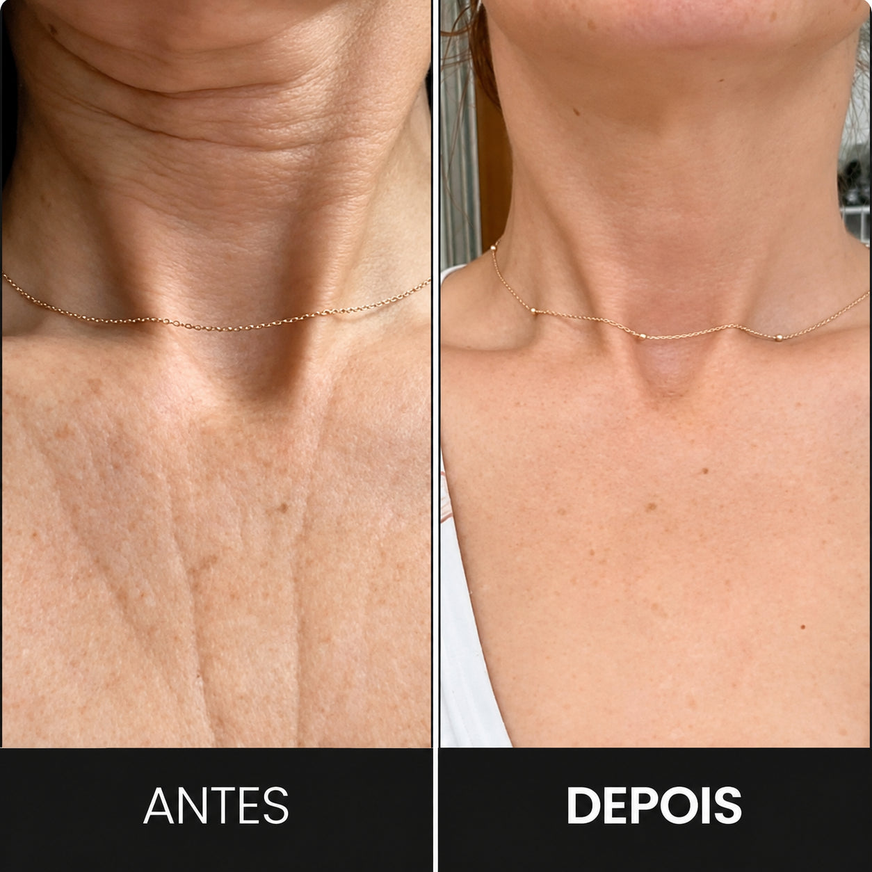 Massageador Facial VitaLift Pro 3 em 1 com Fototerapia