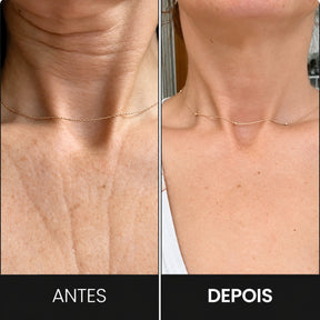 Massageador Facial VitaLift Pro 3 em 1 com Fototerapia