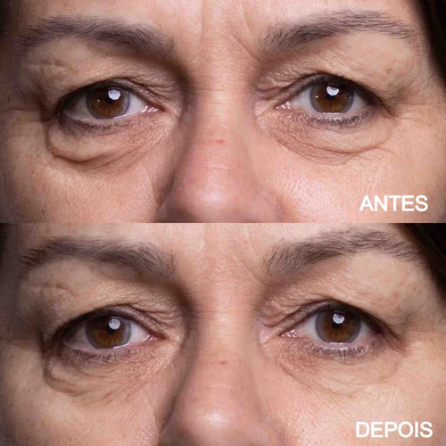 Plaquinha Dermalift® - Olhos