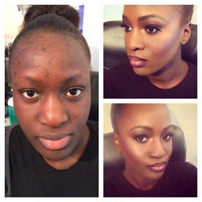 Base Moisture Cushion - Zero Manchas e Expressões