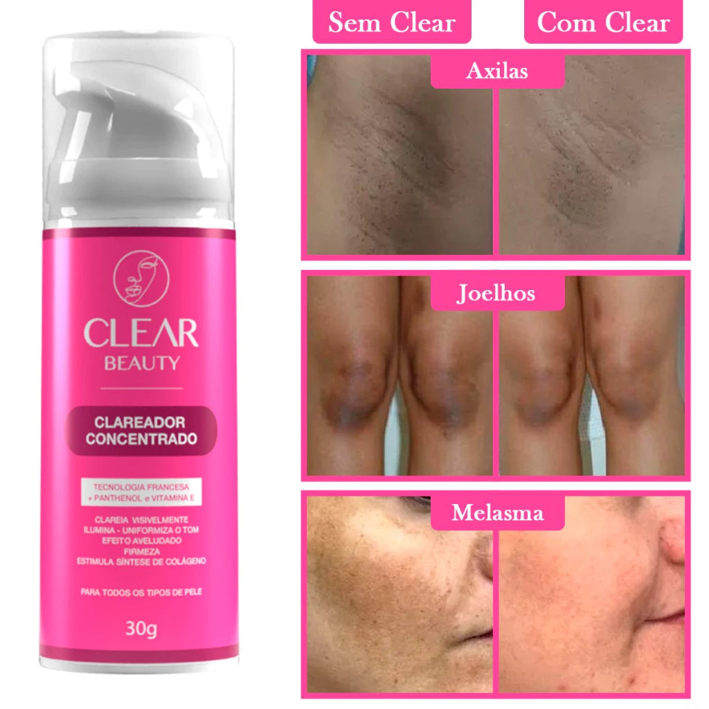 Clear Beauty 3 em 1 – Creme Clareador para Rosto, Axilas e Virilha