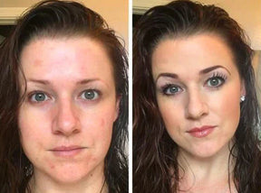 Base Moisture Cushion - Zero Manchas e Expressões