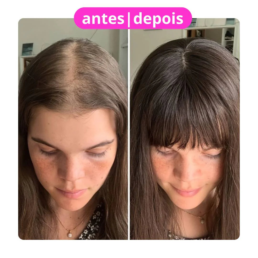 HairGlow Pro 4 em 1 - Escova de Terapia Capilar - Evita Quedas de Cabelo