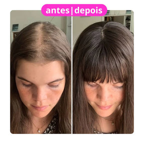 HairGlow Pro 4 em 1 - Escova de Terapia Capilar - Evita Quedas de Cabelo