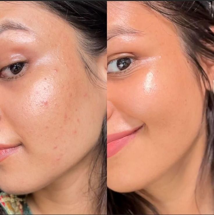 Base Mask Fit Cushion TIRTIR - Ilumina, Protege e Esconde Todas as Imperfeições